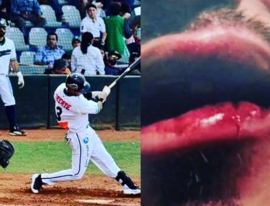 Recibe pelotazo en rostro un aficionado de Los Generales de Durango